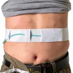 Peritoneal Dialysis Belt AUSTYLCO Adjustable Elastic Catheter Holder-0