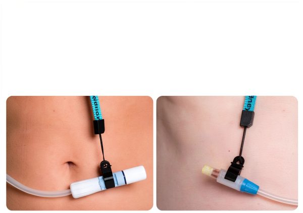 PD Showermate Catheter Showering Support Stickman Dialysis Lanyard-2